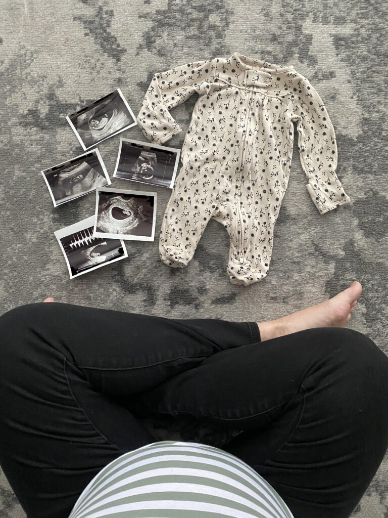 Baby ultrasound photos and black and cream floral baby outfit