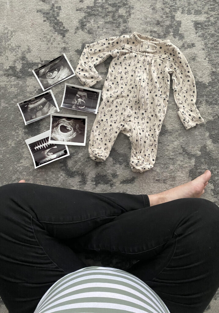 We Had a Baby Baby ultrasound photos and black and cream floral baby outfit